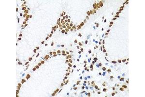 Immunohistochemistry (Paraffin-embedded Sections) (IHC (p)) image for anti-KH Domain Containing, RNA Binding, Signal Transduction Associated 1 (KHDRBS1) antibody (ABIN7261952)