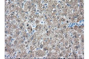 Immunohistochemical staining of paraffin-embedded Human prostate tissue using anti-BHMT mouse monoclonal antibody. (BHMT 抗体)