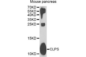 Western blot analysis of extracts of mouse pancreas, using CLPS antibody (ABIN2561908) at 1:1000 dilution. (CLPS 抗体)