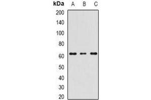Western blot analysis of RIPK2 expression in MCF7 (A), mouse spleen (B), mouse testis (C) whole cell lysates.