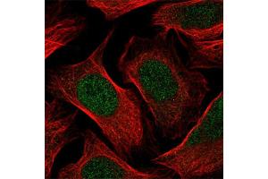 Immunofluorescent staining of human cell line U-2 OS with RBL1 polyclonal antibody  at 1-4 ug/mL concentration shows positivity in nucleus but excluded from the nucleoli. (p107 抗体)
