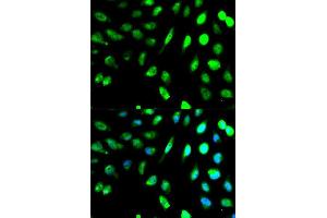 Immunofluorescence analysis of MCF7 cell using KLRD1 antibody. (CD94 抗体  (AA 32-179))