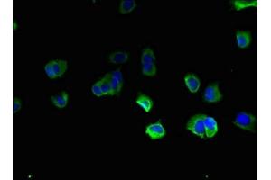 Immunofluorescent analysis of MCF-7 cells using ABIN7171610 at dilution of 1:100 and Alexa Fluor 488-congugated AffiniPure Goat Anti-Rabbit IgG(H+L) (TBC1D2 抗体  (AA 1-237))