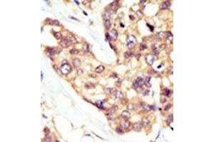 Image no. 2 for anti-Docking Protein 5 (DOK5) (N-Term) antibody (ABIN359962) (DOK5 抗体  (N-Term))