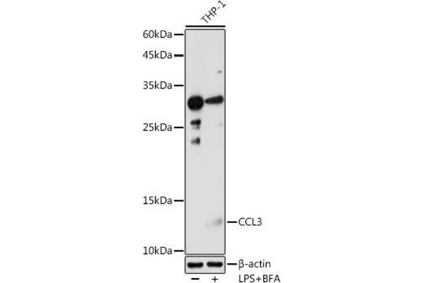 CCL3 抗体  (AA 24-92)