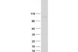 Western Blotting (WB) image for Melanoma Antigen Family D, 2 (MAGED2) (Transcript Variant 1) protein (Myc-DYKDDDDK Tag) (ABIN2725216)
