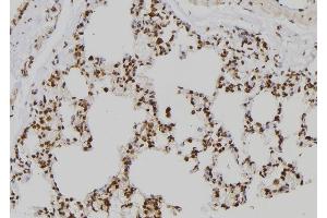 ABIN6258363 and ABIN6273562 at 1/100 staining Rat lung tissue by IHC-P.