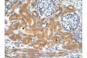 TMEM69 antibody was used for immunohistochemistry at a concentration of 4-8 ug/ml.