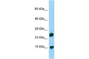 Host: Rabbit Target Name: H2AFV Sample Type: 293T Whole Cell lysates Antibody Dilution: 1. (H2AFV 抗体  (N-Term))