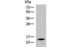 Western blot analysis of Mouse serum using TTR Polyclonal Antibody at dilution of 1:600 (TTR 抗体)