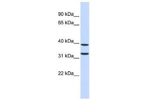 ZNF177 antibody used at 0. (ZNF177 抗体  (Middle Region))
