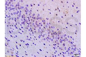 Formalin-fixed and paraffin embedded mouse brain tissue labeled with Anti-BRN3A Polyclonal Antibody, Unconjugated (ABIN702400) at 1:200 followed by conjugation to the secondary antibody, (SP-0023), and DAB staining (POU4F1 抗体  (AA 325-419))