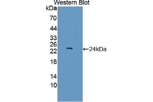 Detection of Recombinant ASCL1, Human using Polyclonal Antibody to Achaete Scute Complex Like Protein 1 (ASCL1) (Achaete Scute Complex Like Protein 1 (AA 84-236) 抗体)