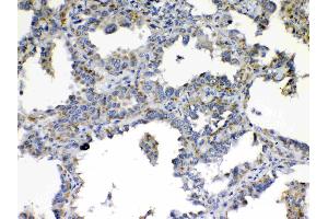 Immunohistochemistry (IHC) image for anti-TIMP Metallopeptidase Inhibitor 4 (TIMP4) (AA 174-224) antibody (ABIN5518879)