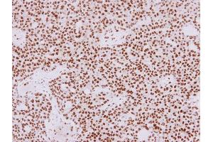 Immunohistochemistry (IHC) image for anti-Histone Deacetylase 1 (HDAC1) antibody (ABIN2854776)