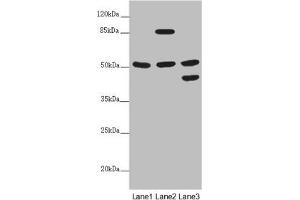 PPP2R3C anticorps  (Regulatory Subunit B)