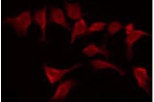 ABIN6269280 staining HepG2 by IF/ICC. (BMX 抗体  (C-Term))