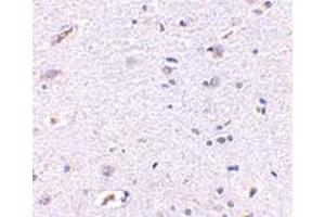 Immunohistochemistry of SNPH in human brain with SNPH polyclonal antibody  at 5 ug/mL . (Syntaphilin 抗体  (N-Term))