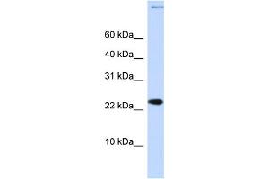 WB Suggested Anti-CHRAC1 Antibody Titration:  0. (CHRAC1 抗体  (Middle Region))