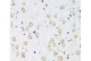 Immunohistochemistry of paraffin-embedded Mouse brain using COTL1 Polyclonal Antibody at dilution of 1:100 (40x lens). (COTL1 抗体)