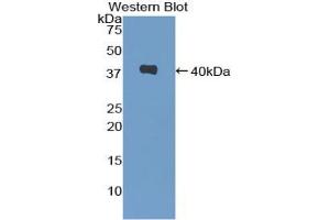 Western blot analysis of the recombinant protein. (CXCL2 抗体  (AA 28-100))