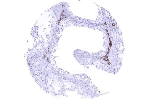 Strong cytoplasmic StAR immunostaining of Leydig cells (Recombinant STAR 抗体)