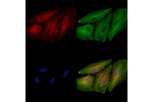 ABIN6264493 and ABIN6277542 staining  cells by IF/ICC.