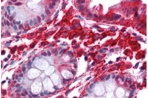 Human Colon: Formalin-Fixed, Paraffin-Embedded (FFPE) (Stathmin 1 抗体  (AA 85-119))