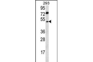 ABHD2 Antibody (Center) (ABIN657007 and ABIN2846187) western blot analysis in 293 cell line lysates (35 μg/lane). (ABHD2 抗体  (AA 263-292))