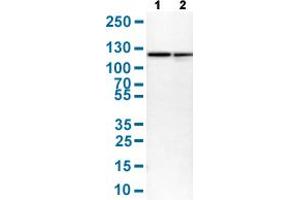 Western Blot analysis with HSPA4 polyclonal antibody . (HSPA4 抗体  (AA 699-808))