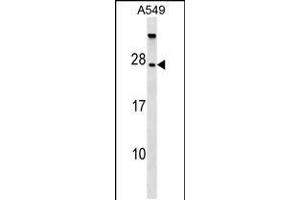 Western blot analysis in A549 cell line lysates (35ug/lane). (TBC1D28 抗体  (AA 48-77))