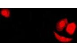 Immunofluorescent analysis of SF2 staining in U2OS cells. (SRSF1 抗体)