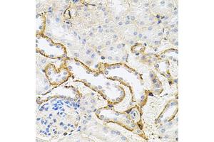 Immunohistochemistry of paraffin-embedded mouse kidney using RPS6KA3 antibody (ABIN5973157) at dilution of 1/100 (40x lens). (RPS6KA3 抗体)