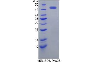 SDS-PAGE analysis of Human EGFR2 Protein. (EGFR2 蛋白)