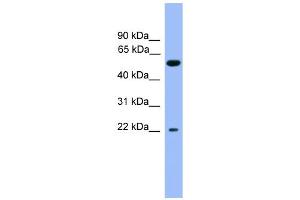 WB Suggested Anti-COCH Antibody Titration: 0. (COCH 抗体  (C-Term))