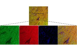 α-Conotoxin GI-FITC and α-Conotoxin GI-ATTO Fluor-647N stain in mouse heart, L&R ventricle frozen sections.