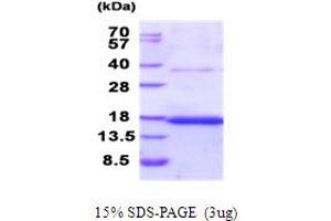SDS-PAGE (SDS) image for Tetraspanin 26 (TSPAN26) (AA 112-241) protein (His tag) (ABIN5853972)