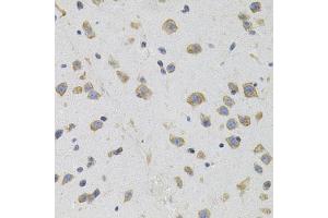 Immunohistochemistry of paraffin-embedded mouse brain using SIGMAR1 antibody (ABIN5973191) (40x lens). (SIGMAR1 抗体)