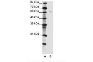 Image no. 1 for anti-Zinc Finger Protein 268A (ZNF286A) (C-Term) antibody (ABIN202711) (ZNF286A 抗体  (C-Term))