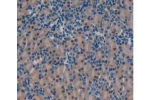 Used in DAB staining on fromalin fixed paraffin- embedded Kidney tissue (YAF2 抗体  (AA 1-179))