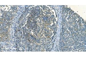 IHC analysis of IDH2 using anti-IDH2 antibody (ABIN7602786).