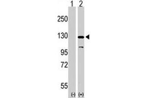 Western blot analysis of DAAM1 (arrow) using DAAM1 polyclonal antibody . (DAAM1 抗体  (N-Term))