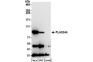 anti-PLA2G4A/cPLA2 (AA 699-749) antibody