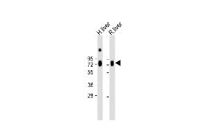 All lanes : Anti-HPX Antibody (Center) at 1:2000 dilution Lane 1: Human liver lysate Lane 2: Rat liver lysate Lysates/proteins at 20 μg per lane. (Hemopexin 抗体  (AA 200-227))