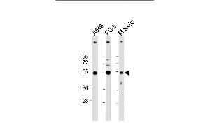 All lanes : Anti-INHBB Antibody (C-term at 1:4000 dilution Lane 1: A549 whole cell lysate Lane 2: PC-3 whole cell lysate Lane 3: Mouse testis lysate Lysates/proteins at 20 μg per lane. (INHBB 抗体  (C-Term))