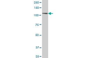 PTK7 monoclonal antibody (M02), clone 4C6 Western Blot analysis of PTK7 expression in A-431 . (PTK7 抗体  (AA 36-145))