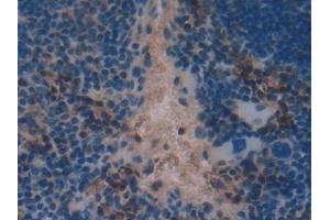 Detection of TFAM in Mouse Spleen Tissue using Polyclonal Antibody to Transcription Factor A, Mitochondrial (TFAM)