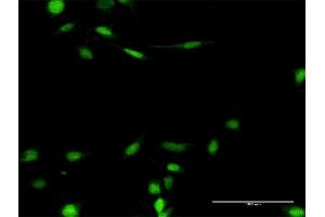 Immunofluorescence of purified MaxPab antibody to SMARCB1 on HeLa cell. (SMARCB1 抗体  (AA 1-385))