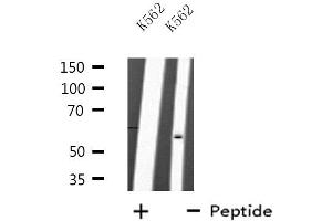 Western blot analysis of extracts from K562 cells, using TRAF2 antibody. (TRAF2 抗体  (C-Term))