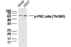 Lane 1: A549 Lane 2: 293T lysates probed with PKC zeta (Thr560) Polyclonal Antibody, Unconjugated  at 1:300 dilution and 4˚C overnight incubation. (PKC zeta 抗体  (pThr560))